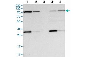 Western blot analysis of Lane 1: RT-4, Lane 2: U-251 MG, Lane 3: Human Plasma, Lane 4: Liver, Lane 5: Tonsil with EXOC2 polyclonal antibody  at 1:250-1:500 dilution.