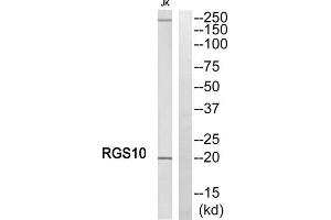 Western blot analysis of extracts from Jurkat cells, using RGS10 antibody. (RGS10 antibody  (Internal Region))