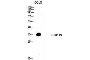 Western Blotting (WB) image for anti-G Protein-Coupled Receptor 119 (GPR119) (Internal Region) antibody (ABIN3184842)