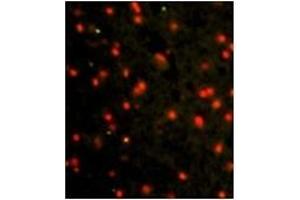 Image no. 1 for anti-Cadherin 4 (CDH4) (AA 182-211), (N-Term) antibody (ABIN356865) (Cadherin 4 antibody  (N-Term))