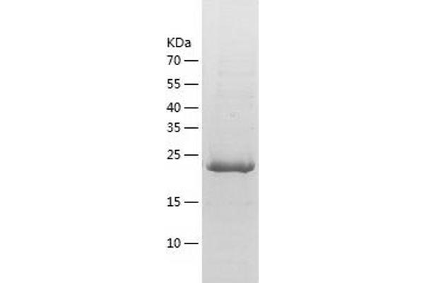 TCEAL2 Protein (AA 1-227) (His tag)