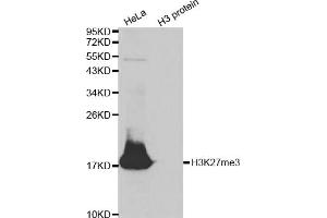 Western blot analysis of extracts of various cell lines, using Trimethyl-Histone H3-K27 antibody (ABIN5969810) at 1/500 dilution. (Histone 3 antibody  (H3K27me3))