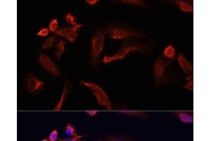 Immunofluorescence analysis of U2OS cells using TYMS Polyclonal Antibody at dilution of 1:100. (TYMS antibody)