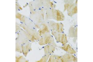 Immunohistochemistry of paraffin-embedded rat skeletal muscle using TRAP1 Antibody (ABIN1875197) at dilution of 1:100 (40x lens). (TRAP1 antibody)