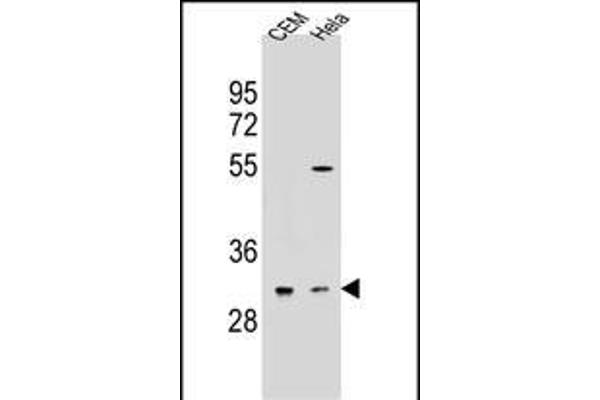 OR5L2 antibody  (N-Term)