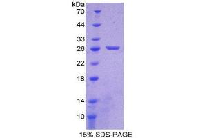 SDS-PAGE (SDS) image for Complement Component 1, Q Subcomponent, A Chain (C1QA) (AA 28-245) protein (His tag) (ABIN1878552)