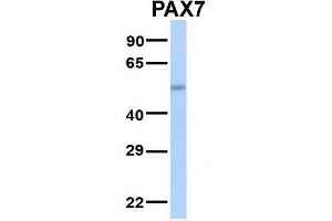 Host:  Rabbit  Target Name:  SERPINA3  Sample Type:  Human Adult Placenta  Antibody Dilution:  1. (PAX7 antibody  (Middle Region))