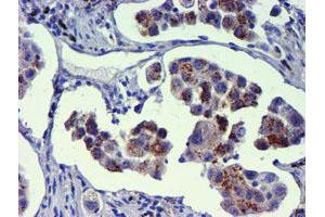 Image no. 5 for anti-Golgi Membrane Protein 1 (GOLM1) antibody (ABIN1498494) (GOLM1 antibody)