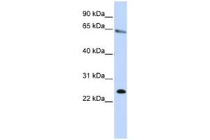 ZNF326 antibody used at 0. (ZNF326 antibody  (N-Term))