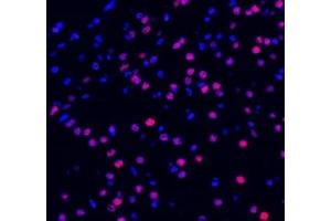 Immunofluorescent analysis of paraformaldehyde-fixed mouse brain using ADRA1B (ABIN7072974) at dilution of 1: 1200 (ADRA1B antibody)
