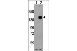 Western blot analysis of P3K5 (arrow) using rabbit polyclonal P3K5 Antibody g. (ASK1 antibody  (AA 821-849))