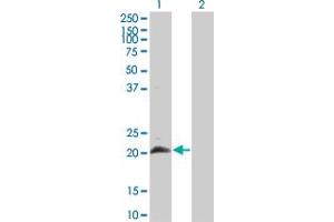 Western Blot analysis of HAND2 expression in transfected 293T cell line by HAND2 monoclonal antibody (M04), clone 4E12.