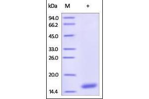 Human Cystatin S, His Tag on SDS-PAGE under reducing (R) condition. (CST4 Protein (AA 21-141) (His tag))