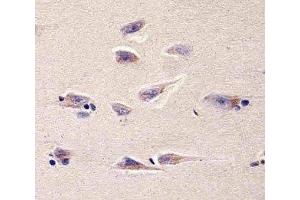 Immunohistochemical analysis of paraffin-embedded human brain section using DHFR antibody; Ab was diluted at 1:25 dilution. (Dihydrofolate Reductase antibody  (AA 1-50))