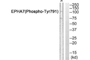 Western Blotting (WB) image for anti-EPH Receptor A7 (EPHA7) (pTyr791) antibody (ABIN1847868) (EPH Receptor A7 antibody  (pTyr791))