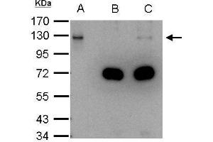 IP Image DDB1 antibody immunoprecipitates DDB1 protein in IP experiments. (DDB1 antibody  (C-Term))