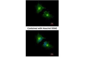ICC/IF Image Immunofluorescence analysis of methanol-fixed HeLa, using SCAMP3, antibody at 1:1000 dilution. (SCAMP3 antibody)
