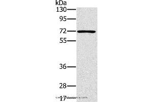 Western blot analysis of Raji cell, using PLS3 Polyclonal Antibody at dilution of 1:400