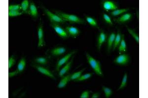 Immunofluorescence staining of Hela cells with ABIN7175108 at 1:33, counter-stained with DAPI. (UMPS antibody  (AA 314-444))