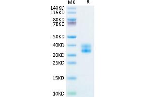 Biotinylated Human 4-1BB on Tris-Bis PAGE under reduced condition. (CD137 Protein (AA 24-186) (His-Avi Tag,Biotin))