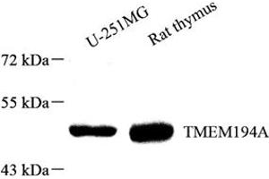 Western blot analysis of TMEM194A (ABIN7075997) at dilution of 1: 1000 (TMEM194A antibody)