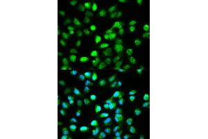 Immunofluorescence analysis of HeLa cell using TCF4 antibody. (TCF4 antibody)