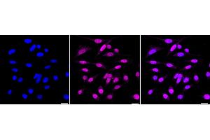 Immunocytochemical staining of HepG2 cells with JunD antibody (ABIN7799143), 1:1,000).