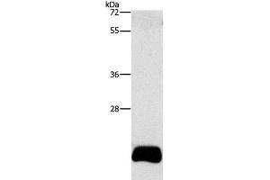Western Blot analysis of PC3 cell using APOBEC3C Polyclonal Antibody at dilution of 1:420 (APOBEC3C antibody)