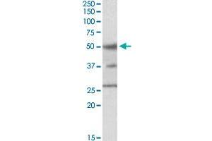 FOXA1 polyclonal antibody  staining (1 ul/mL) of HepG2 cell lysate (35 ug protein in RIPA buffer).