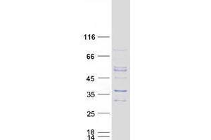 WBSCR27 Protein (Myc-DYKDDDDK Tag)