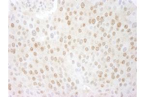 Immunohistochemistry (IHC) image for anti-COP9 Constitutive Photomorphogenic Homolog Subunit 5 (Arabidopsis) (COPS5) (AA 175-225) antibody (ABIN7448494) (COPS5 antibody  (AA 175-225))