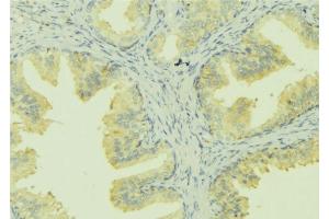 ABIN6273028 at 1/100 staining Mouse colon tissue by IHC-P.