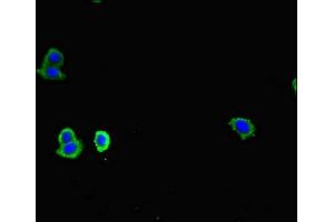 Immunofluorescent analysis of HepG2 cells using ABIN7147186 at dilution of 1:100 and Alexa Fluor 488-congugated AffiniPure Goat Anti-Rabbit IgG(H+L) (CD83 antibody  (AA 20-144))