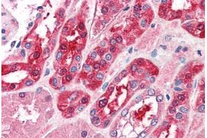Human Kidney (formalin-fixed, paraffin-embedded) stained with MID2 antibody ABIN337007 at 5 ug/ml followed by biotinylated anti-goat IgG secondary antibody ABIN481715, alkaline phosphatase-streptavidin and chromogen. (Midline 2 antibody  (AA 723-735))