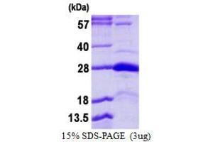 Image no. 1 for Serine/threonine/tyrosine Interacting Protein (STYX) (AA 26-223) protein (His tag) (ABIN6386916)