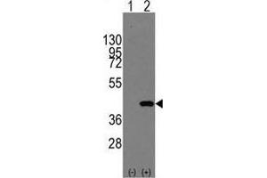 Western blot analysis of MAPK14(arrow) using rabbit polyclonal MAPK14 Antibody (Y322) . (MAPK14 antibody  (Tyr322))