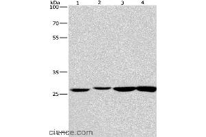 Western blot analysis of Humna colon cancer and mouse kidney tissue, mouse testis and human fetal brain tissue, using KLF7 Polyclonal Antibody at dilution of 1:483. (KLF7 antibody)