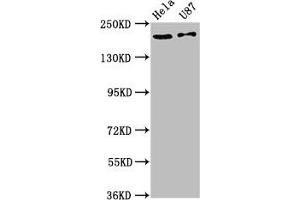SCN1A antibody  (AA 992-1099)