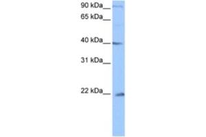 Western Blotting (WB) image for anti-Chromosome 4 Open Reading Frame 33 (C4orf33) antibody (ABIN2463479) (C4orf33 antibody)