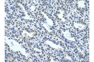 Immunohistochemistry (Paraffin-embedded Sections) (IHC (p)) image for anti-Nuclear Receptor Subfamily 2, Group F, Member 2 (NR2F2) (N-Term) antibody (ABIN2792599)