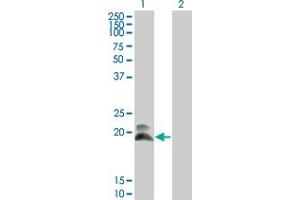 Western Blot analysis of HAND2 expression in transfected 293T cell line by HAND2 monoclonal antibody (M01), clone 4H8. (HAND2 antibody  (AA 135-216))