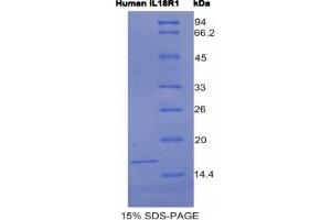 SDS-PAGE analysis of Human IL18R1 Protein.