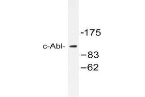 Western blot analysis of c-Abl Antibody in extracts from 293 cells. (ABL1 antibody)