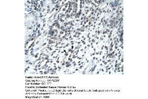 Human kidney (SIRT5 antibody  (Middle Region))