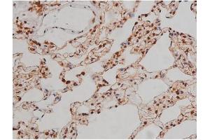 ABIN6267336 at 1/200 staining Rat lung tissue sections by IHC-P. (IGF1R antibody  (pTyr1346))
