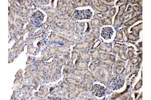 IHC analysis of PNP using anti-PNP antibody . (PNP antibody  (Middle Region))