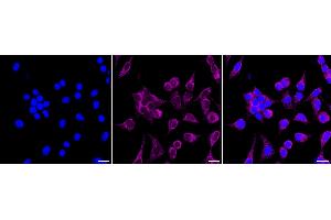 Immunocytochemical staining of HeLa cells with NFATC1 antibody (ABIN7799636), 1:1,000).