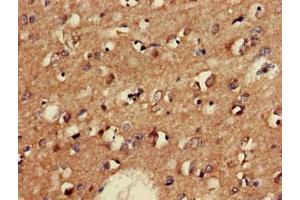 Immunohistochemistry of paraffin-embedded human brain tissue using ABIN7153954 at dilution of 1:100 (GAD65 antibody  (AA 1-82))