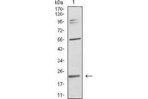 Western blot analysis using IL28A mouse mAb against SK-Br-3 (1) cell lysate. (IL28A antibody  (AA 1-200))