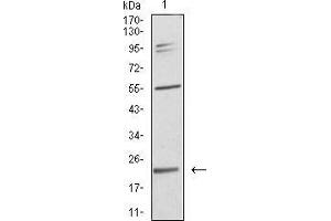 Western blot analysis using IL28A mouse mAb against SK-Br-3 (1) cell lysate. (IL28A antibody  (AA 1-200))